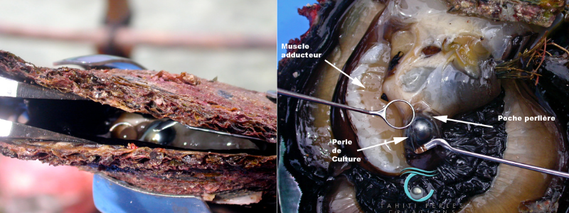 La perle, telle que la voit le greffeur, au travers des coquilles entrouvertes de la nacre. La deuxième photo montre l'anatomie de la nacre avec la perle dans la gonade de l'huître perlière.

